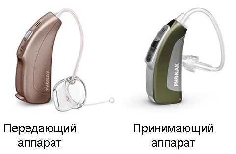 Слухопротезирование при односторонней глухоте слуховой аппарат, Односторонняя глухота, слух, слухопротезирование