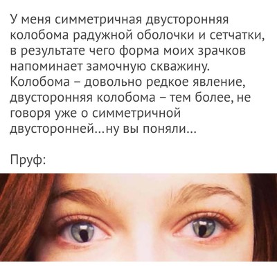 Как сделать зрачки вертикальными. Смотреть фото Как сделать зрачки вертикальными. Смотреть картинку Как сделать зрачки вертикальными. Картинка про Как сделать зрачки вертикальными. Фото Как сделать зрачки вертикальными