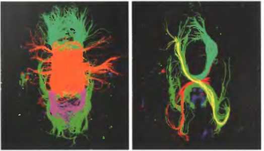 One Me, One Brain [8 attempt, cycle start - Split Brain] - Brain, The science, Neurobiology, Cognitive Neurobiology, Right hemisphere, Left hemisphere, Humor, Longpost