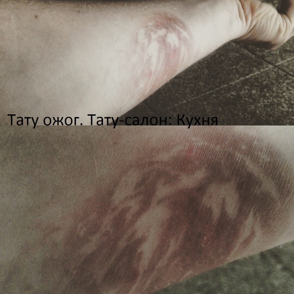 ���� ����