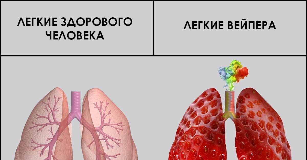 Какие бывают легкие. Легкие курильщика вейпа. Лёхгия курильщика и вейпера. Лёгкие курильщика и лёгкие вейпера.