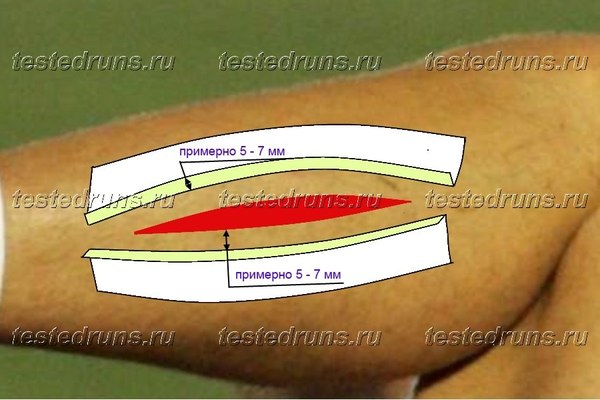 WOUND SUITATION WITH ADHESIVE PATCH - Help, Wound, Longpost, , Danger