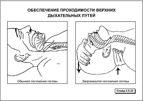 First aid in case of an accident - Ambulance, First aid, Text, Longpost