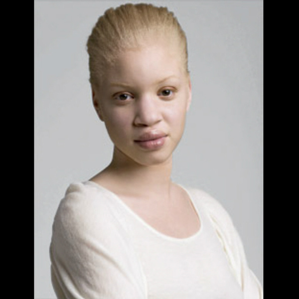 Unusual appearance of a girl v 2.0 - Albino, Black people, Girls