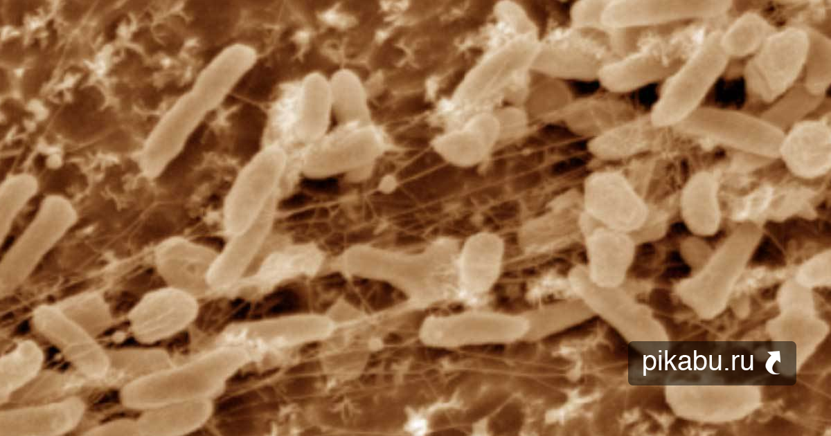 Разрушающие микроорганизмы. Ideonella sakaiensis. Бактерия Ideonella sakaiensis. Бактерии разлагающие пластик. Ideonella sakaiensis 201-f6.