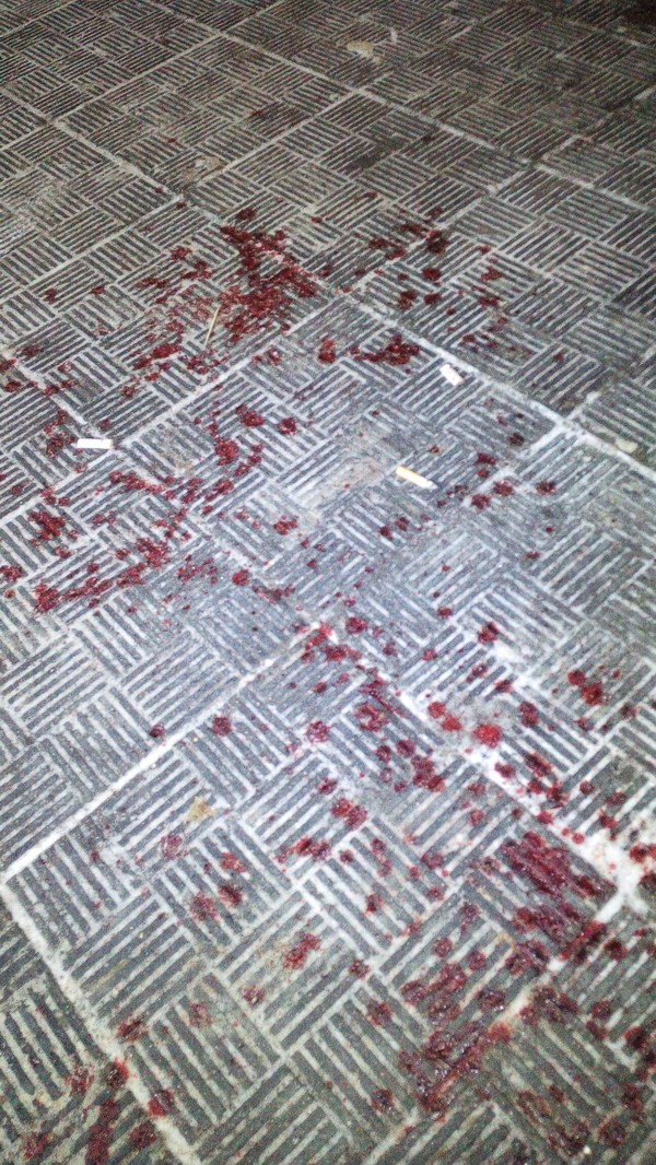 Саранск... Пятница удалась на славу... - Кровь, Длиннопост, Моё, Пятница