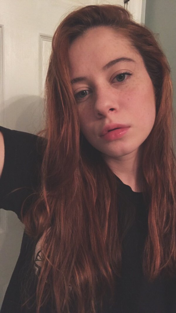 Веснушки, это мило) | Пикабу