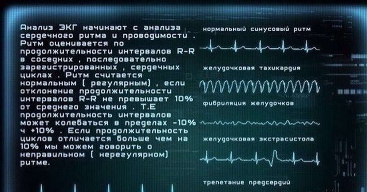 Прочитать экг по фото онлайн