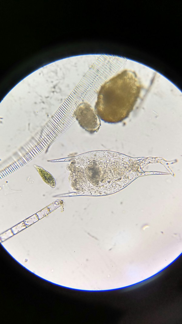 Коловратка фото. Коловратка филодина Philodina. Bdelloidea коловратки. Коловратки сканирующий микроскоп. Микроб Коловратка.