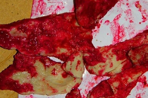 serratia odorifera что это. Смотреть фото serratia odorifera что это. Смотреть картинку serratia odorifera что это. Картинка про serratia odorifera что это. Фото serratia odorifera что это