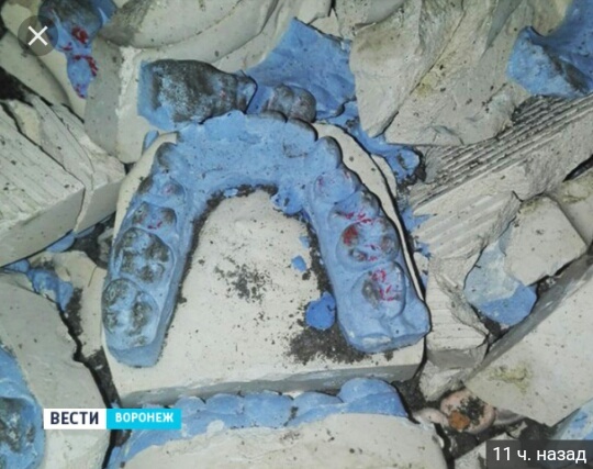 In Voronezh, a hole in the road was covered with plaster jaws - Voronezh, Jaws, Road, Longpost