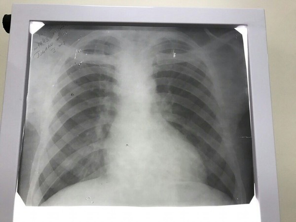 Tell me the diagnosis - X-ray, The medicine, Help, Diagnosis