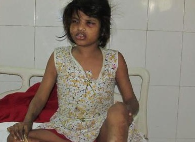 Girl raised by monkeys found in India - news, India, Mowgli, Girl, Longpost