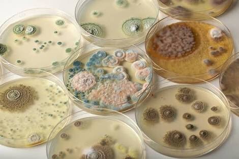 Some cultures of microbacteria - The medicine, Microbiology, Bacteria, Agario, Environment, Images, Longpost