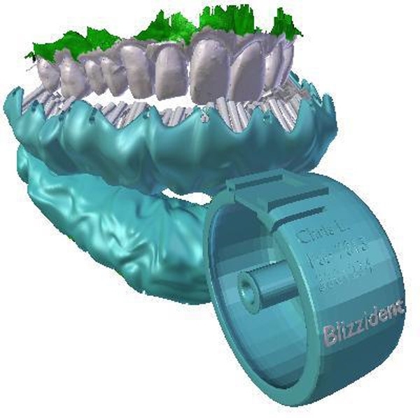 Blizzident is the strangest toothbrush - Toothbrush, Dentistry, Hygiene, Wow, Video, Longpost