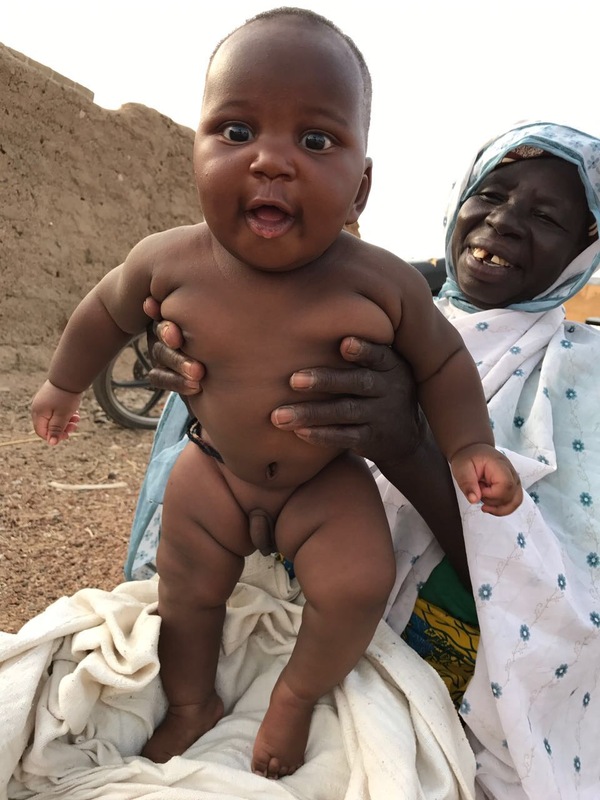 African boy - My, Health, Africa, Nigeria, My, The photo, Boy