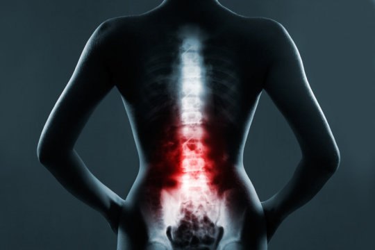 SPINAL CORD STIMULATION - a safe, effective treatment for chronic pain - , Article, The science, My, Zaporizhzhia, The medicine, Spine, Back, Implants