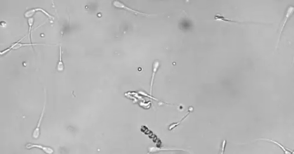 Микробот засовывает сперматозоид в яйцеклетку, Гифка, Нанотехнологии, Микро...