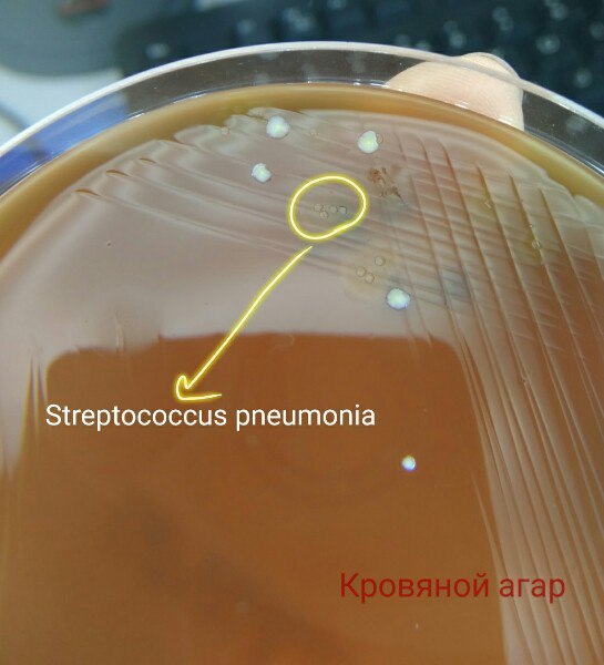 And again plant environments - Longpost, The medicine, Microbiology, Environment, Bacteria, The photo, Text