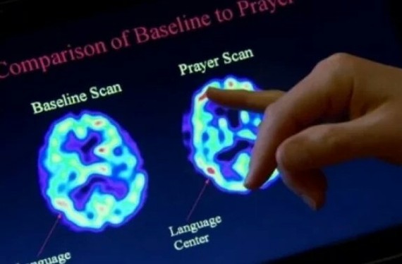 How prayer affects the human brain and consciousness. - Prayer, Research, Neurophysiology, Brain, faith, Religion, Longpost