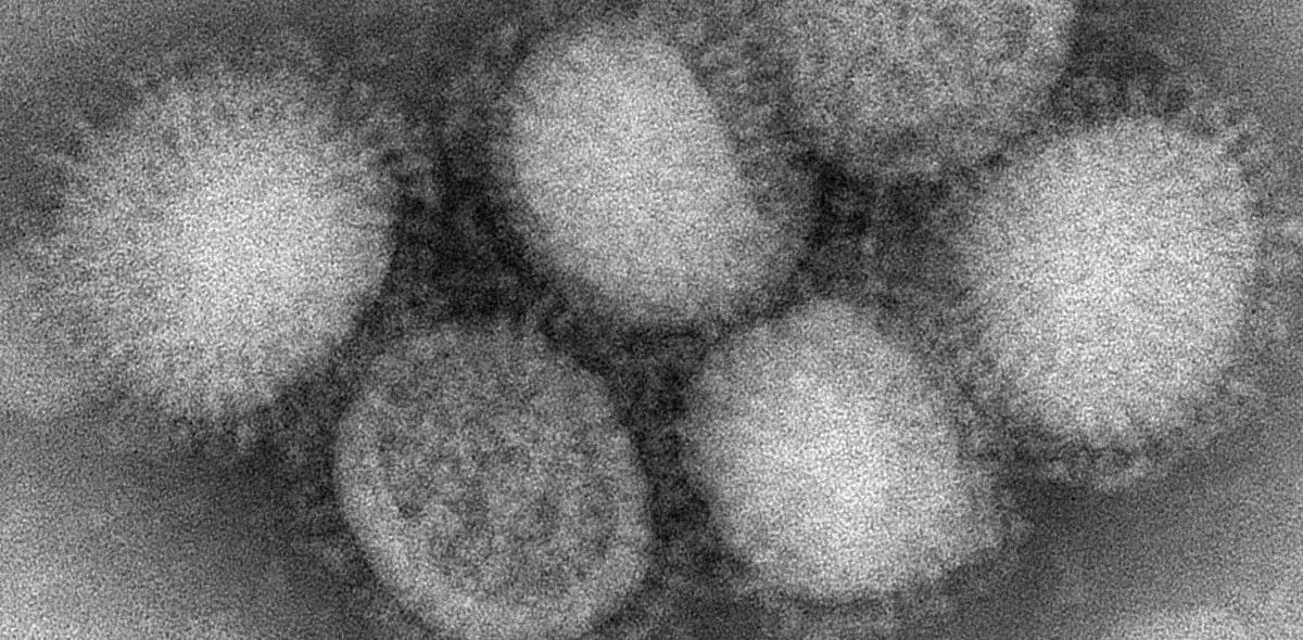 Вирус гриппа под. Вирус гриппа электронная микроскопия. Вирус гриппа микрофотография. Электронная микрофотография вируса гриппа а. Вирус гриппа под микроскопом и коронавирус.