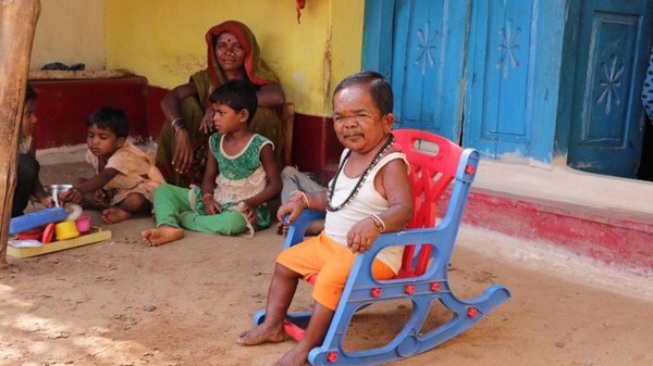 50-year-old Indian stops growing at age 5 - India, Little people, Video