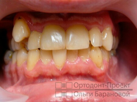 Лиге стоматолов, если здесь такая есть