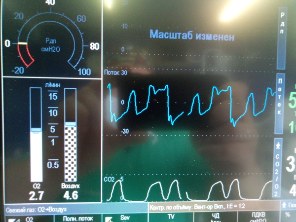 The device draws cats. - My, Mechanical ventilation, cat, Work