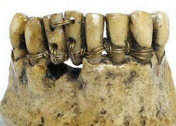 Вехи истории