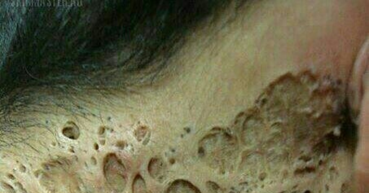 Трипофобы негодуют | Пикабу