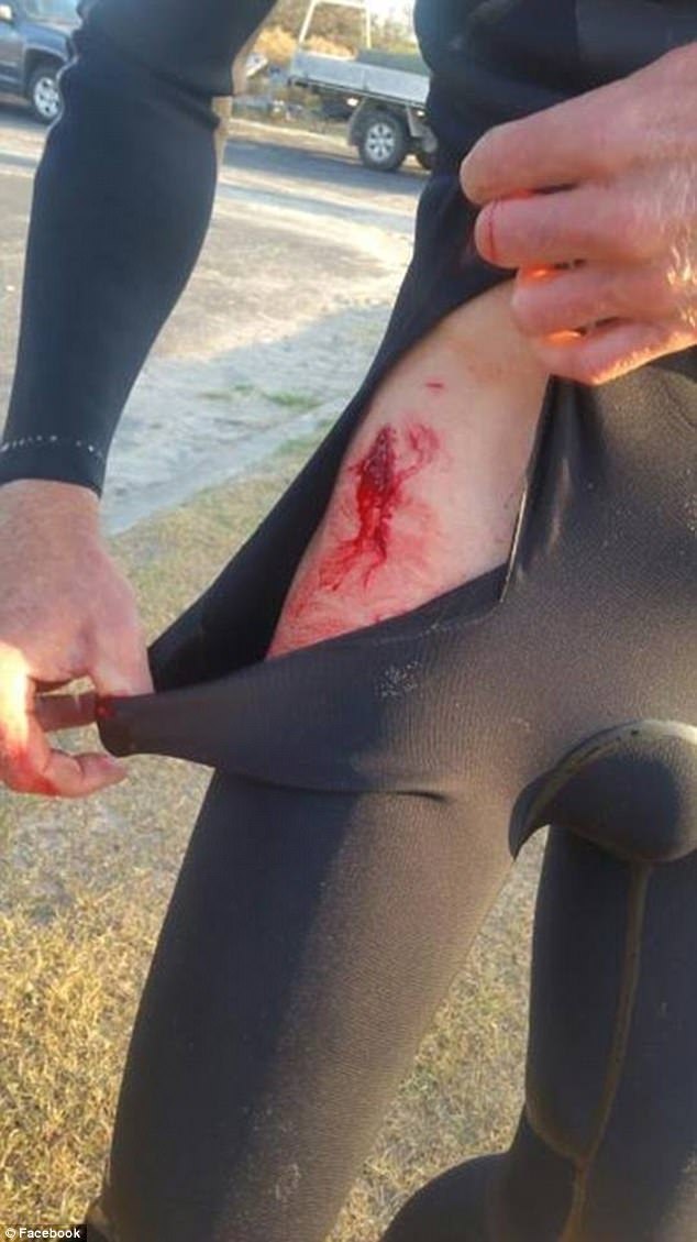 A great white shark almost killed a surfer, but he was able to fight it off with a piece of board - Shark, Surfing, Surfer, Luck, Survived, Danger, Longpost