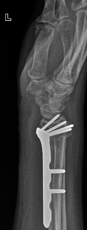 From the life of a radiologist. Part 1. - My, Radiology, Sos, Osteosynthesis, Longpost, The medicine