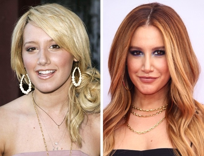 What celebrities looked like before plastic surgery - ADME, Plastic surgery, Celebrities, Longpost