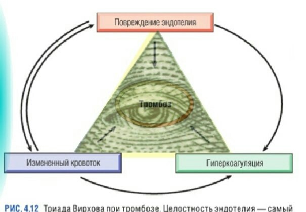 Thrombosis is the work of a secret world government! - Thrombosis, Теория заговора, Illuminati, Screenshot