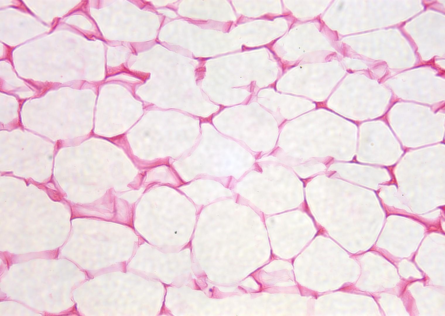 Жировая ткань латынь. Жировая соединительная ткань. Белая жировая соединительная ткань. Белая жировая ткань под микроскопом. Жировая ткань анатомия.