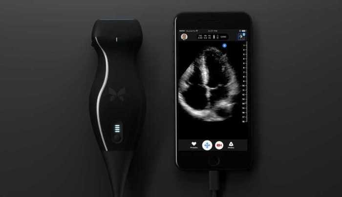 Pocket ultrasound machine that connects to a smartphone - Longpost, Video, Гаджеты, The medicine, Ultrasound