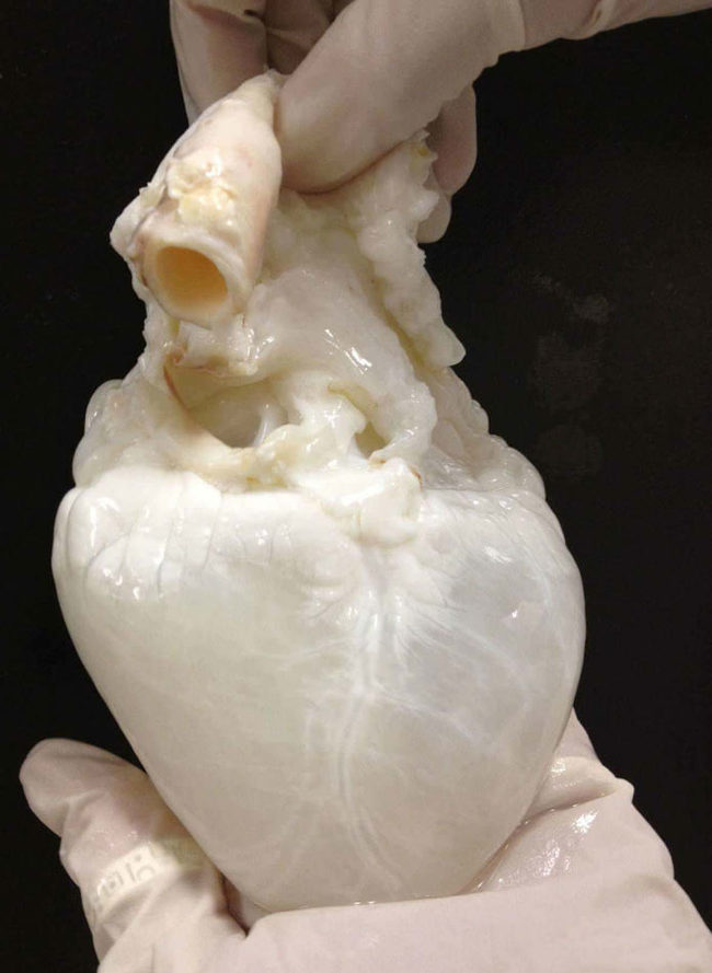 This is what a broken heart looks like - Heart, Interesting, white white