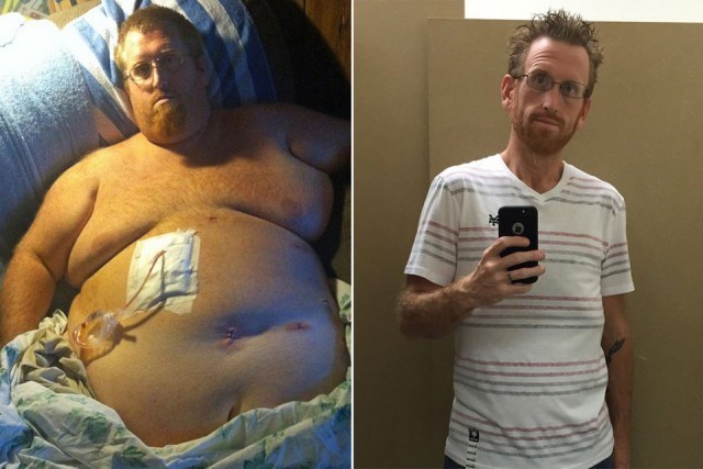 Чтобы не умереть от лишнего веса, американец скинул 160 кг Полнота, Худые, Целенаправленность, Длиннопост