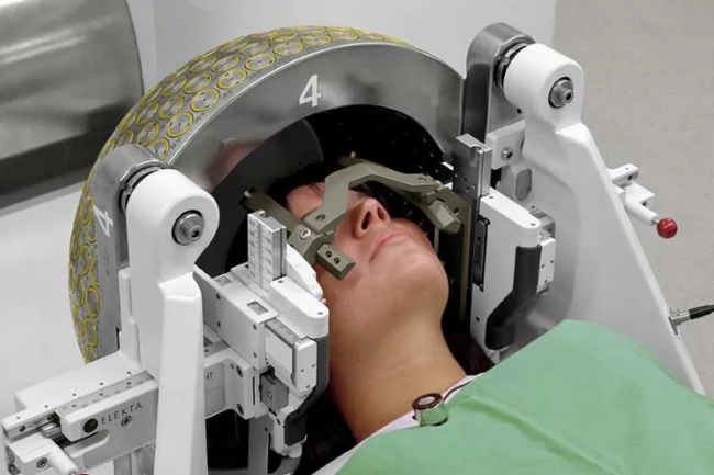 Treatment with Gamma Knife. - My, Disease, Brain cancer, Treatment, Longtext, Gamma Knife, Longpost