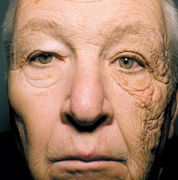 A photo of a truck driver shows 28 years of sun exposure - The photo, The sun, Driving