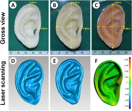 The Chinese have grown new ears for children from their own cells - The science, news, The medicine, 3D печать, Ears