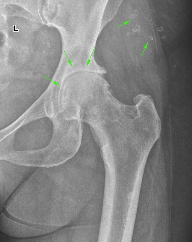 From the life of a radiologist. Part 17 - My, X-ray, Radiology, The medicine, Longpost