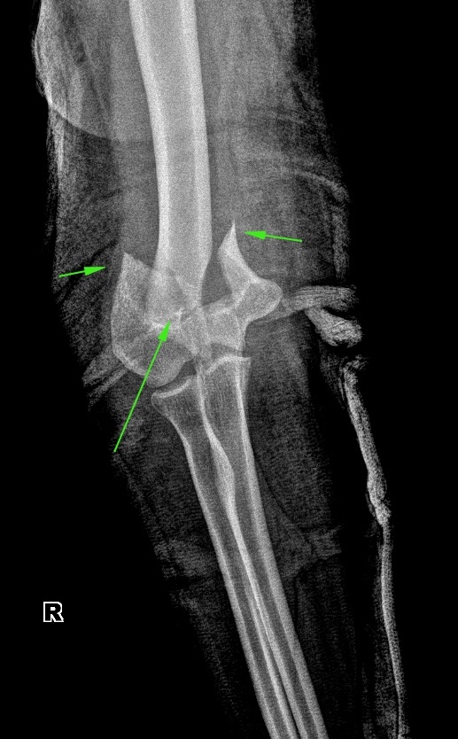 From the life of a radiologist. Part 17 - My, X-ray, Radiology, The medicine, Longpost