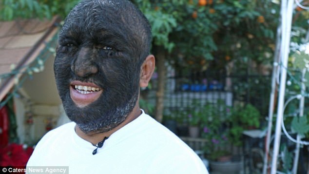 Larry Gomez is the hairiest man on earth - Hypertrichosis, Hair, Guinness Book of Records, , Longpost