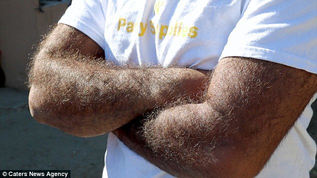 Larry Gomez is the hairiest man on earth - Guinness Book of Records, , Longpost, Hair, Hypertrichosis