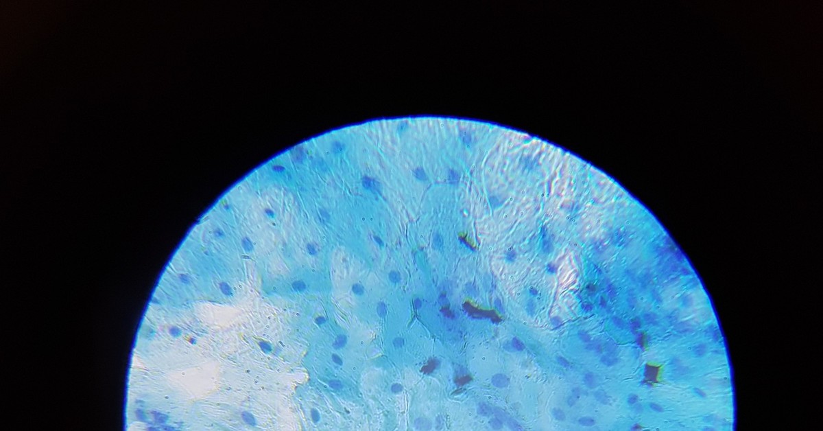Клетки слизистой полости рта. Буккальный эпителий микроскоп. Клетки эпителия ротовой полости. Метиленовый синий гистология. Эпителий ротовой полости микроскоп.