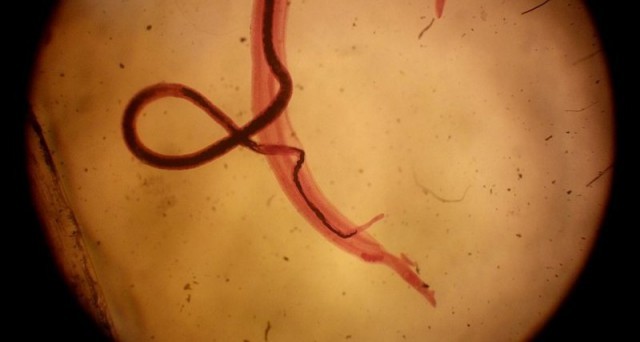 Get infected with parasites for 1000 euros: a scientific experiment in the Netherlands - The photo, Parasites, , Longpost