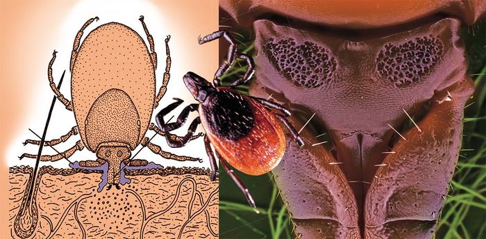 Tick ??bites and other bloodsucking gifts - Mite, Encephalitis, Tick-borne borreliosis, , Longpost, Infection