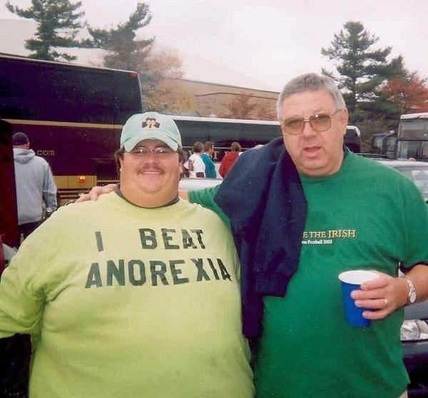 I beat anorexia - Anorexia, Obesity, T-shirt, Print, Fat man, League of Fat Men, Fullness