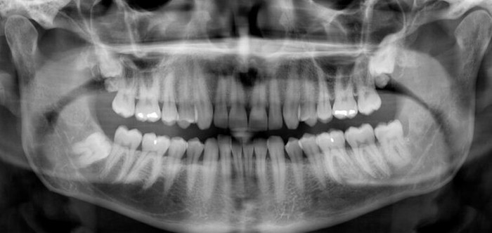 Dentistry. - The medicine, Dentistry, My, Longpost, Teeth